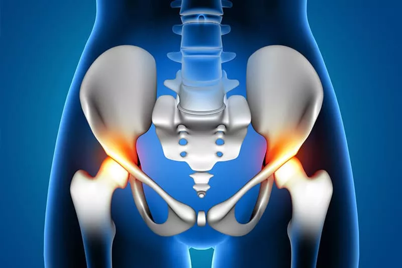 Direct Anterior (DA) Hip Replacement Surgery Direct Anterior (DA) Hip Replacement Surgery