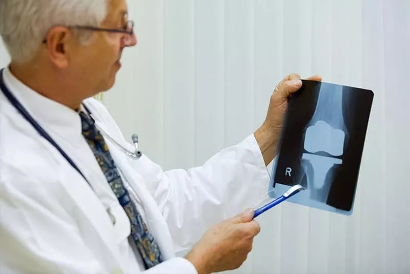 What's the Difference Between Total Knee and Partial Knee Replacement?