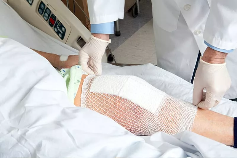 How Long Is the Recovery Period from Total Knee Replacement? How Long Is the Recovery Period from Total Knee Replacement?