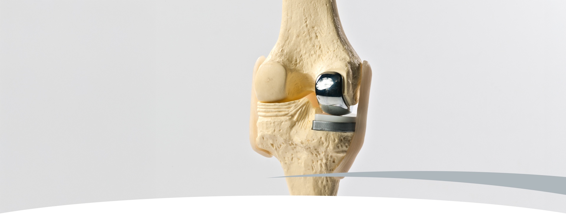 Photo: Cementless Partial Knee Replacement